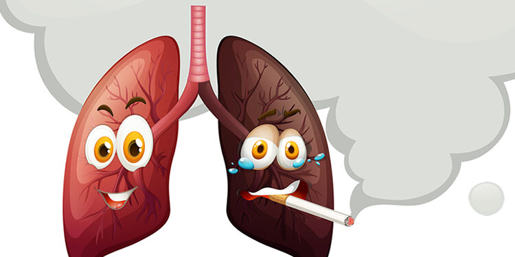 Koah (Kronik Obstrüktif Akciğer Hastalığı) Nedir? ve Beslenme Tedavisi Nasıldır?